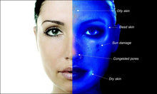 Janssen Pico/Q-Switched ND YAG Laser Tattoo Removal