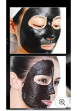 Janssen Pico/Q-Switched ND YAG Laser Tattoo Removal