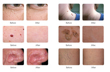 Janssen Ultra Skin Repair System