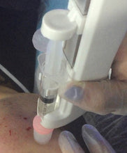 Janssen Hydra Micro Needling