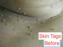 Janssen Ultra Skin Repair System