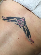 Janssen Pico/Q-Switched ND YAG Laser Tattoo Removal